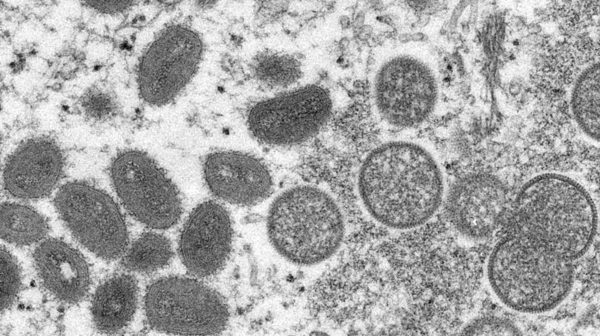 The first two cases of monkeypox confirmed in Quebec, Canada