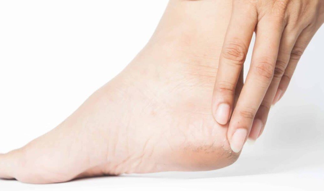 ਸਰਦੀਆਂ ਦੇ ਮੋਸਮ ‘ਚ ਫਟੀ ਅੱਡੀਆਂ ਤੋਂ ਛੁਟਕਾਰਾ ਪਾਉਣ ਲਈ ਅਪਣਾਓ ਇਹ ਘਰੇਲੂ ਉਪਚਾਰ