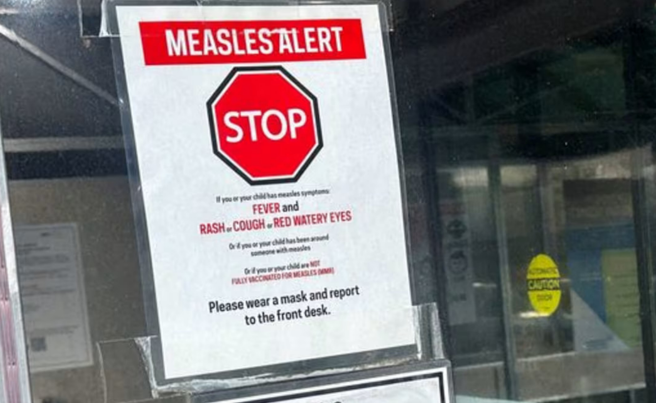Canada Measles Outbreak: 28 ਸਾਲਾਂ ਬਾਅਦ ਕੈਨੇਡਾ ਨੇ ਗੁਆਈ ‘Measles-Free’ ਪਛਾਣ, ਦੇਸ਼ ਭਰ ‘ਚ ਵੱਧ ਰਹੇ ਮਾਮਲੇ ਚਿੰਤਾ ਦਾ ਕਾਰਨ |